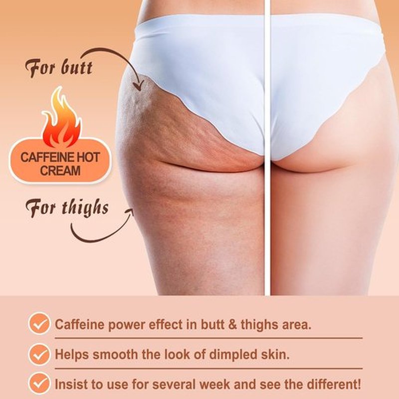 Skiennix Caffeine Hot Cream - Cellulite Treatment for Butt & Thighs | Skin Tightening Formula, 5.5 Oz
