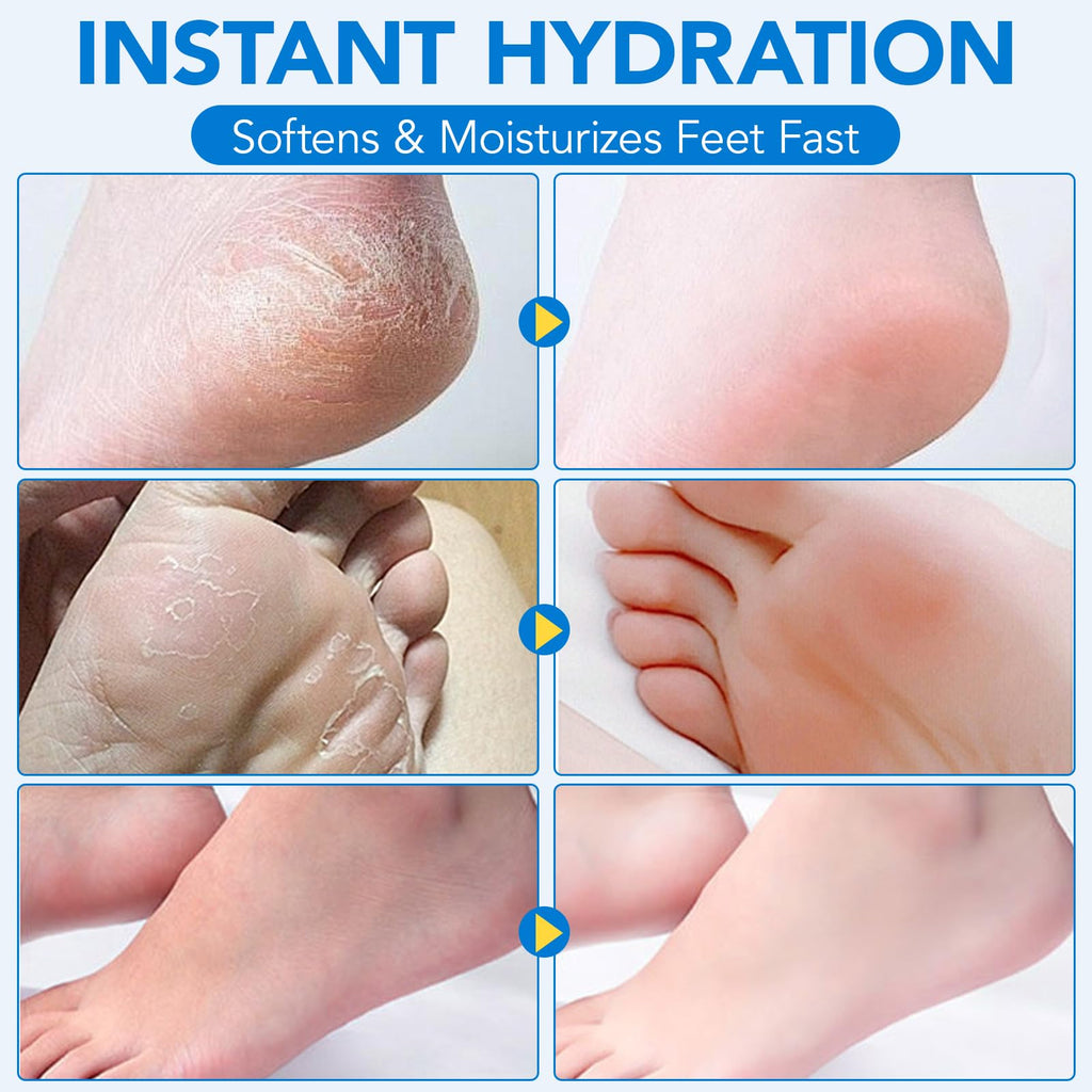 WeiWeiLa Urea Cream, Intensive Foot Repair Stick 60% Urea with 2% Salicylic Acid Heel Balm Stick, Maximum Strength Callus Remover Foot Care Cream for Cracked Heels, Dry Feet & Rough Skin