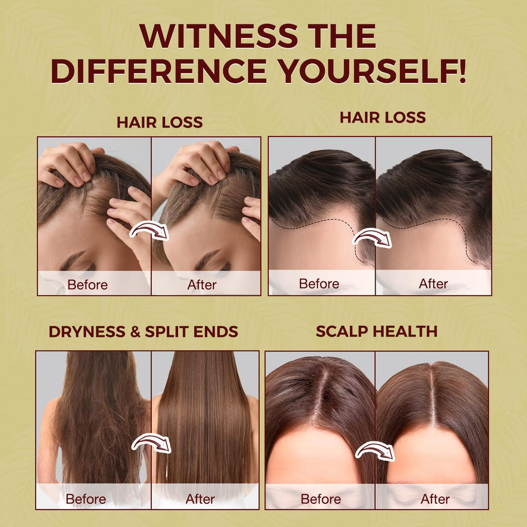 Lupure Batana Oil for Hair Growth: 100% Raw Batana Oil Pure Organic and Natural Hair Growth Treatment, Sourced from Honduras, Prevents Hair Loss, Enhances Hair Thickness for Men & Women, 4.2 OZ