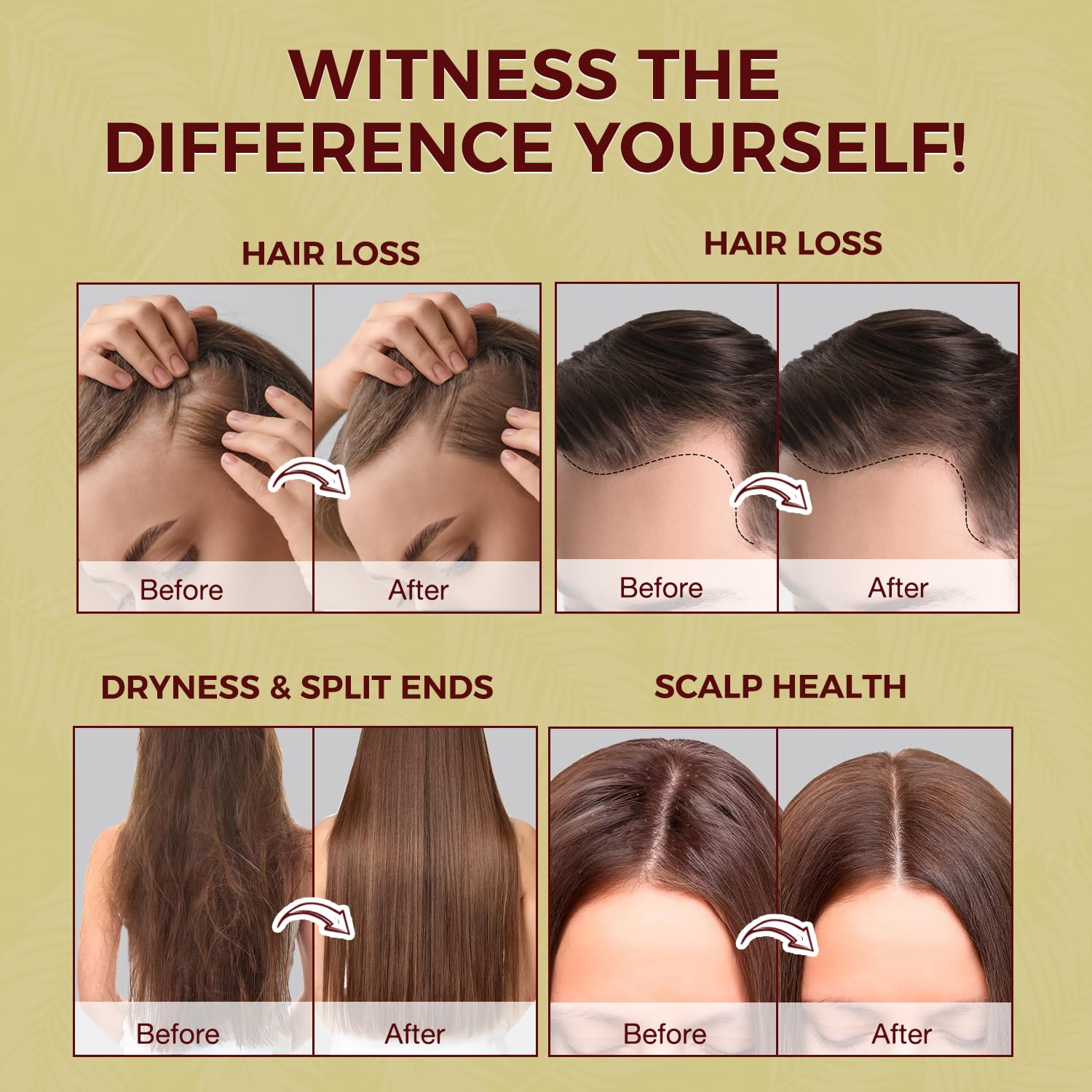 Lupure Batana Oil for Hair Growth: 100% Raw Batana Oil Pure Organic and Natural Hair Growth Treatment, Sourced from Honduras, Prevents Hair Loss, Enhances Hair Thickness for Men & Women, 4.2 OZ