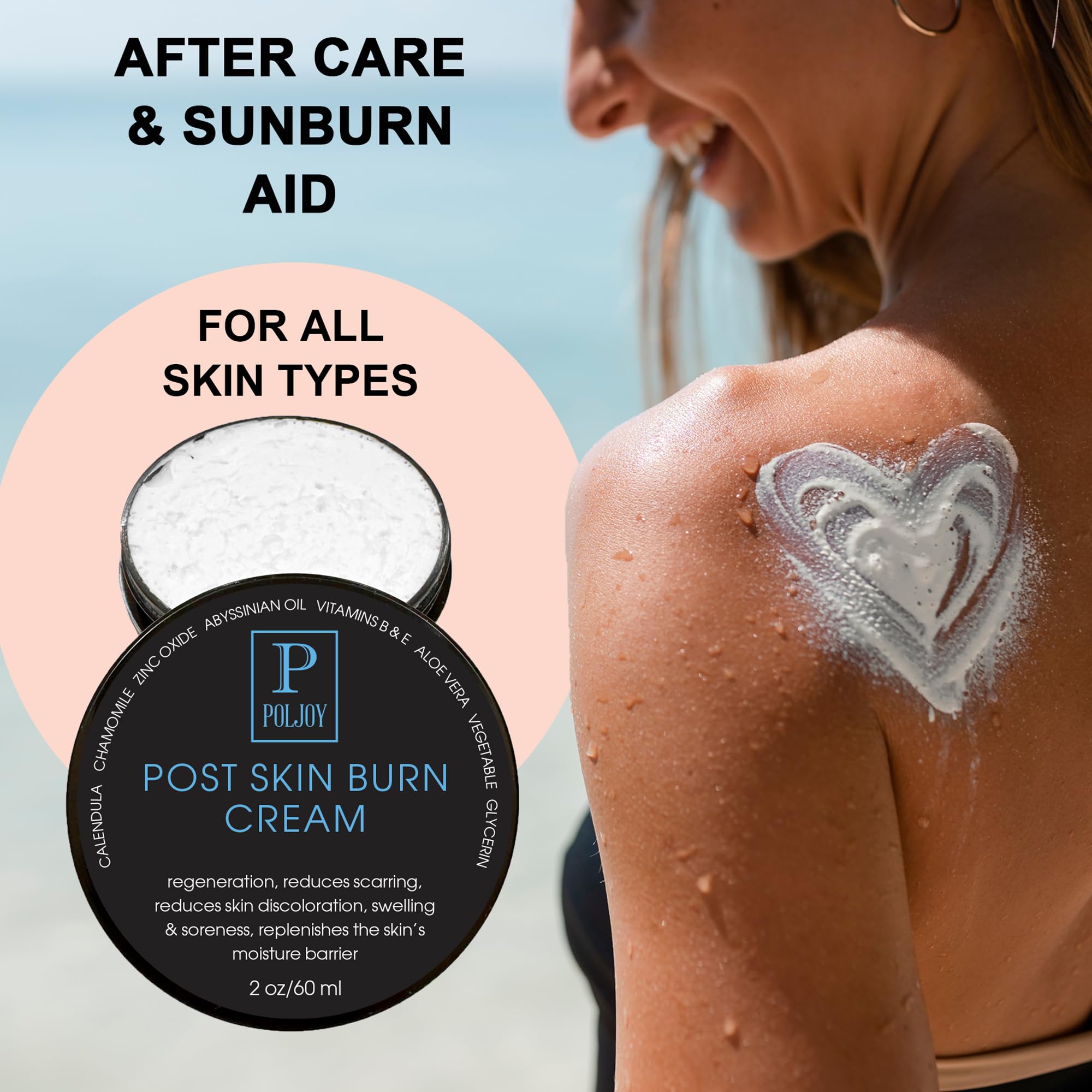 PolJoy Post Skin Burn Cream, Sunburn Cream for First Aid Treatment, Hydrates & Repairs Skin with Aloe Vera, Shea Butter, Zinc Oxide, Calendula, Coconut Oil & Vitamins B&E, Kitchen & Travel Use