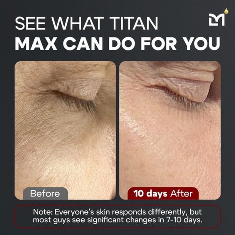 Man Labs Titan MAX Anti-Aging Face Serum for Men – Ultra Potency Mens Face Lotion – Skin Tightening Cream for Face – Mens Skin Care – Vitamin C & E, 10% Niacinamide, Hyaluronic Acid – Unscented