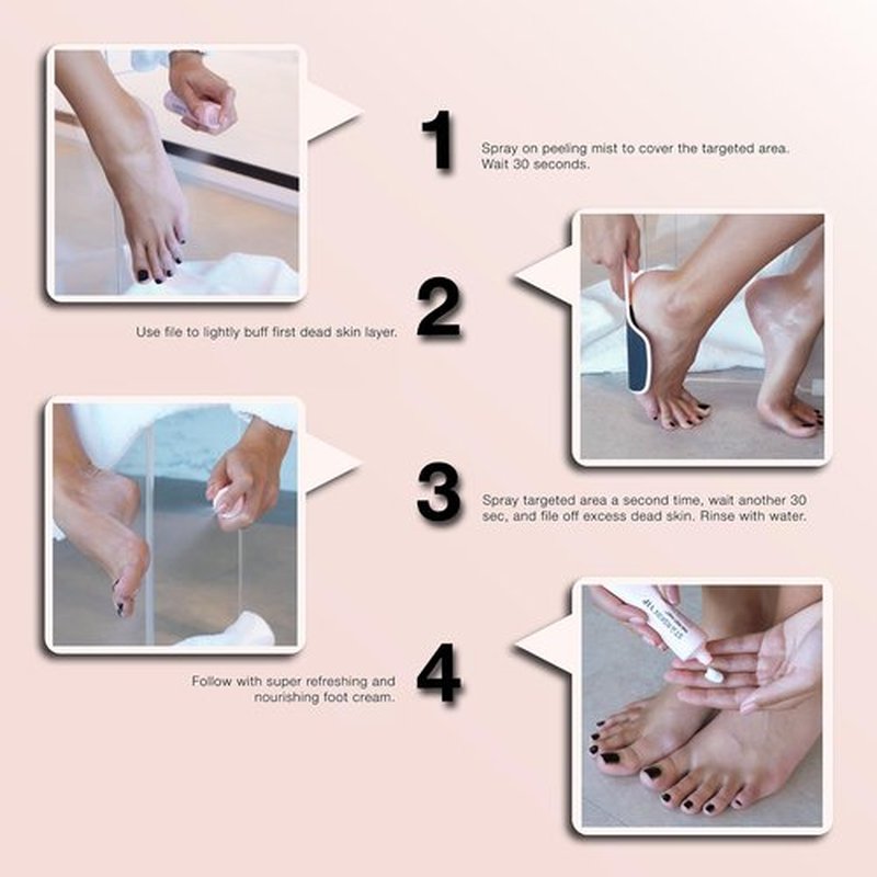 STARSKIN Fab Feet Fast, Instant Foot Peeling Spray, Foot File & Foot Cream for Soft & Smooth Skin, Premium Callus Remover for Rough Cracked & Dry Feet