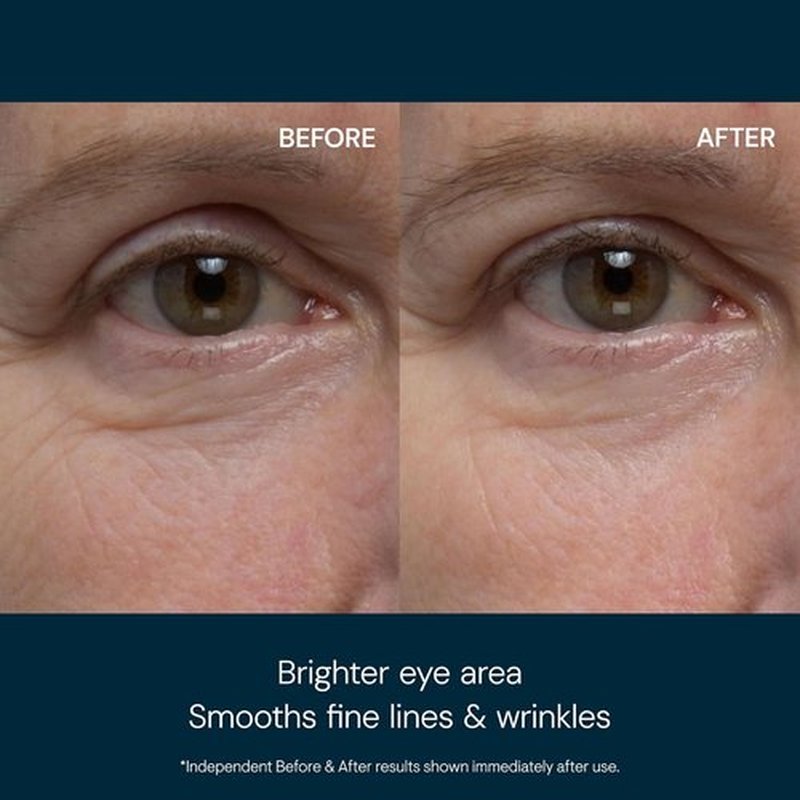 ELEMIS Pro-Collagen Eye Revive Mask - Anti-Wrinkle Treatment That Brightens, Rejuvenates & Hydrates