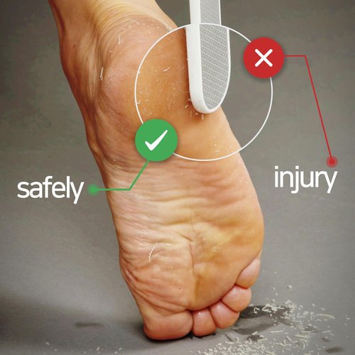 Baren Magic Professional Dual Sided Foot Callus Remover Shaver - Painless and Gentle Remove | Professional Tool | Premium Stainless Steel | for Dry Foot | Foot File | Easy to Clean