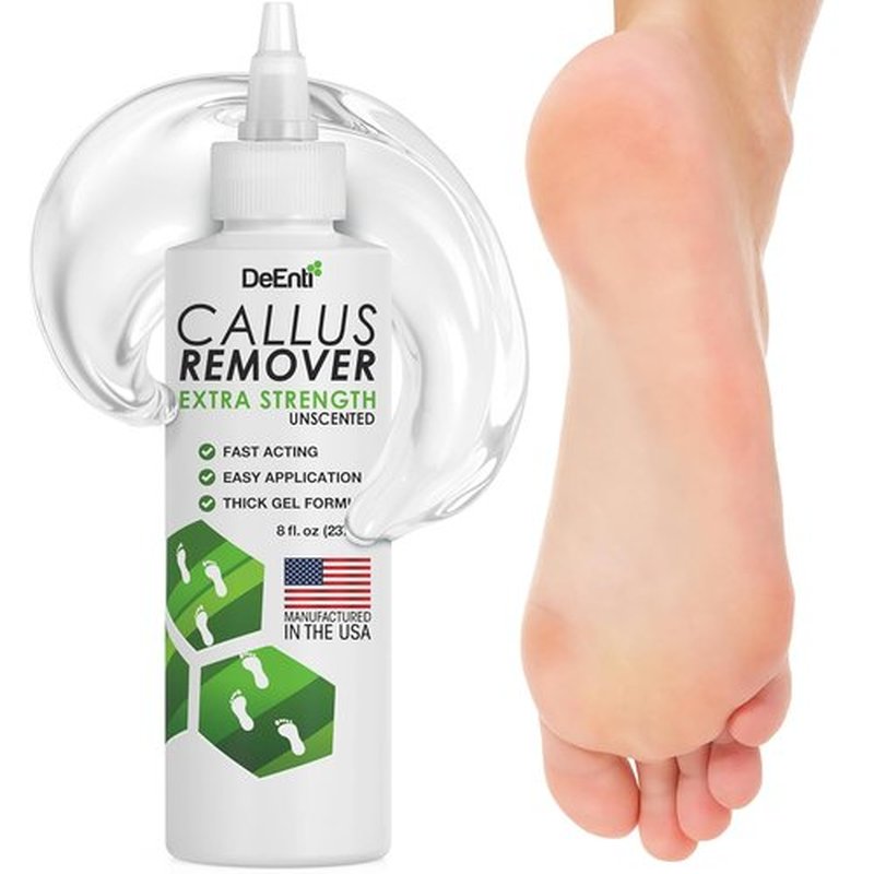 DeEnti Callus Remover Gel - Extra Strength 8oz for Dry Skin & Cracked Heels | Salon-Grade Foot Care