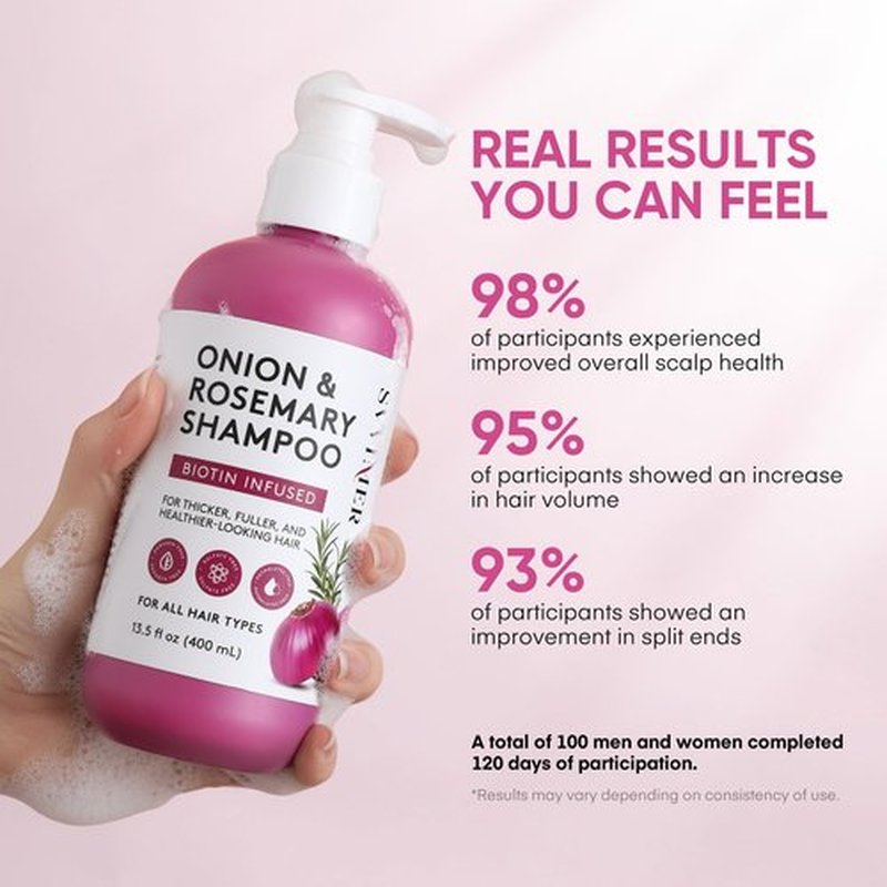 Svvimer Onion Rosemary and Biotin Shampoo - Hair Growth Shampoo for Hair Loss and Thinning - Thickening and Strengthening Formula for Men & Women Sulfate Free 13.5 Fl Oz (Pack of 1)