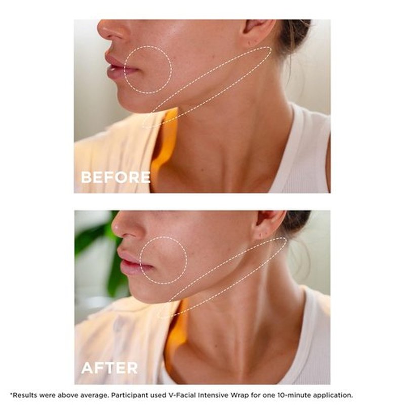 Clarins V-Facial Intensive Wrap Face Mask - Award-Winning Contouring Treatment | Reduces Puffiness & Swelling | 2.5 Oz
