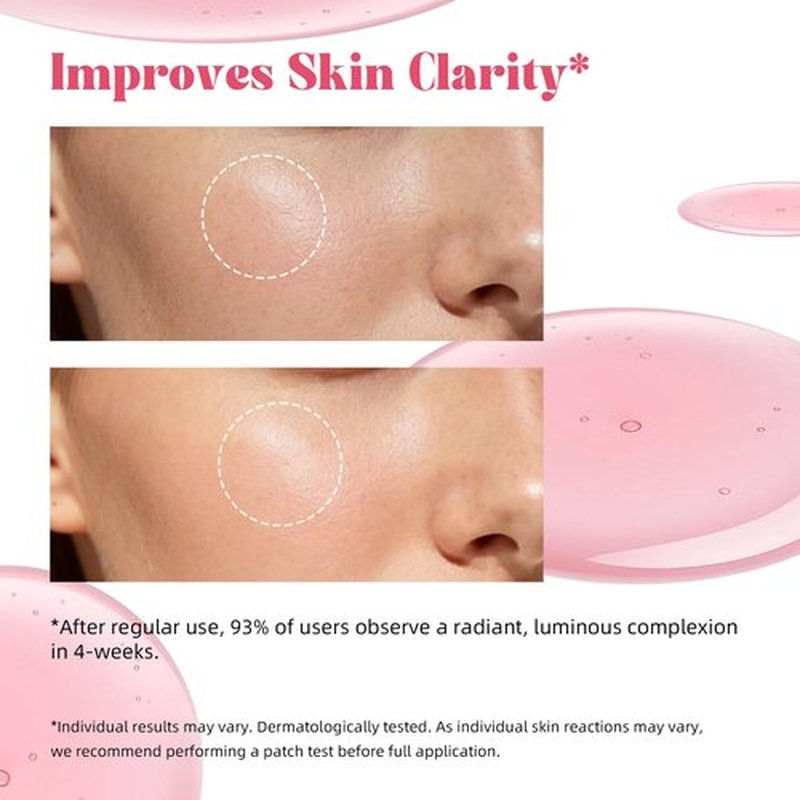 ANRCOLLECT 5% Tranexamic Acid + 10% Niacinamide Serum for Tone Perfecting, Post-Acne Care, Radiant Glow - with Kojic Acid, Ceramides, Hyaluronic Acid - 30ML Vegan Skincare