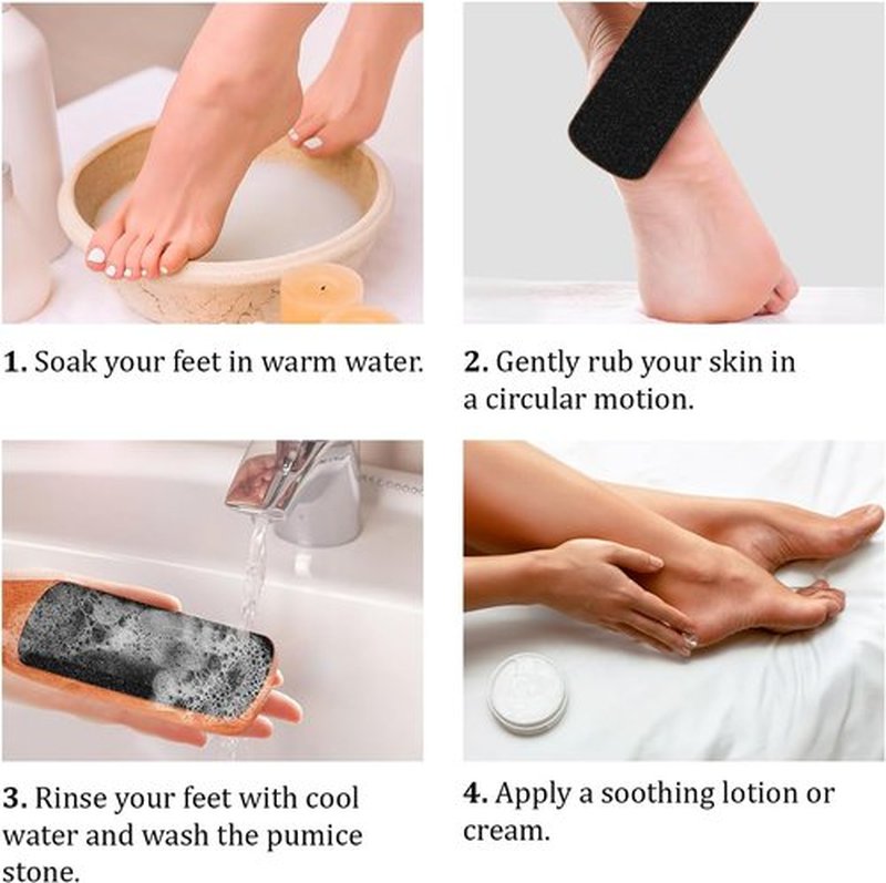 Skiennix Foot File - Double-Sided Pumice Stone for Callus Removal & Smooth Feet | Ideal for Dry Skin