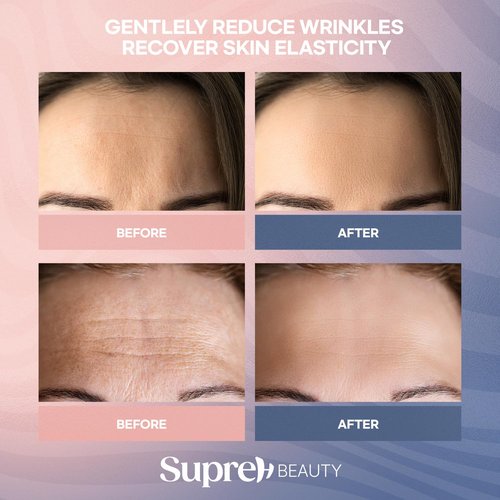 SupreH Forehead Wrinkle Patches For Anti-Wrinkle: Facial Wrinkle Patches for Forehead Fine Lines & Frown Lines - Overnight Mask 14 Patches