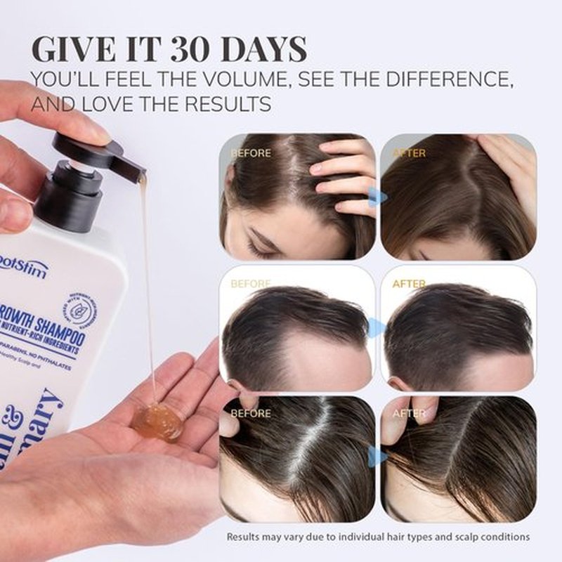 Biotin & Rosemary Shampoo for Hair Growth: Hair Loss Shampoo for Thinning Hair Infused with Nutrient Rich Ingredients for Hair thickening Sulfate Free 10 fl oz