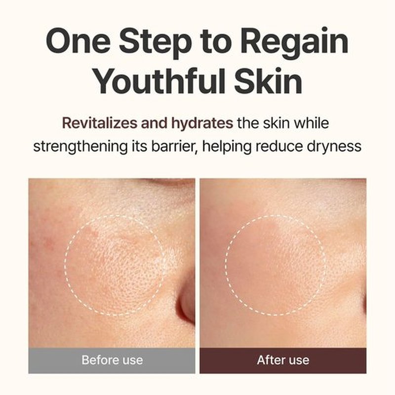 CENTELLIAN 24 PDRN Firming Boosting Ampoule - Enhanced Skin Elasticity | 1.01 fl oz, 300,000 ppm PDRN
