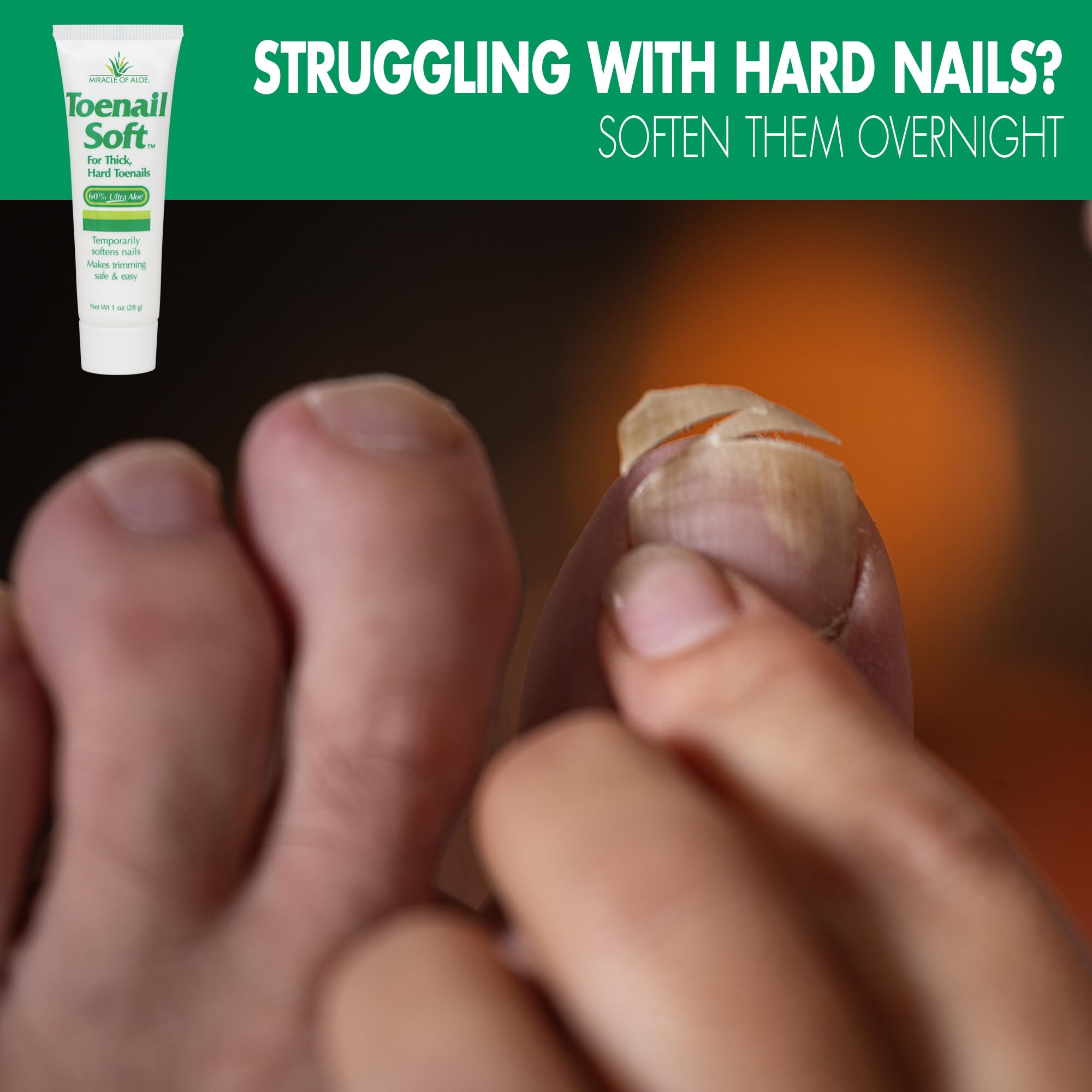 Toenail Softener for Thick Hard Toenails - Safe for Seniors & All Ages - Fast-Acting Toenail Softening Cream - Non Greasy Nail Cream Formulated with Natural Aloe Vera (1 Ounce Tube (Pack of 2))