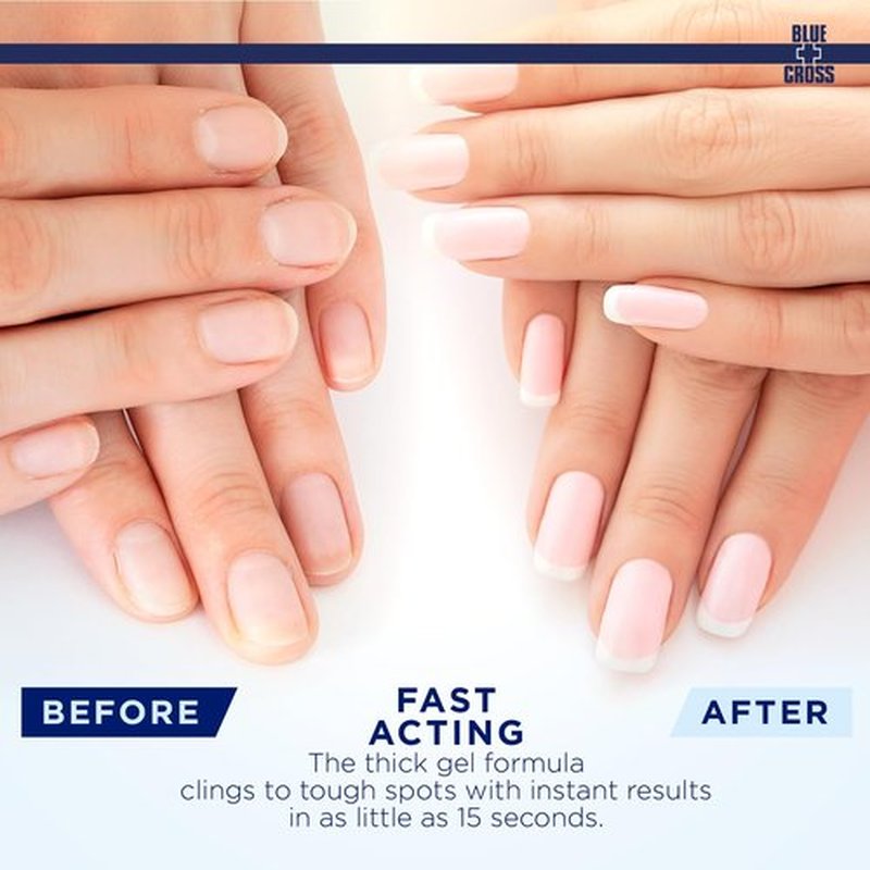 Blue Cross Cuticle Remover Gel - Hydrating Cuticle Softener for Dry Nails | 8oz Eucalyptus & Tea Tree