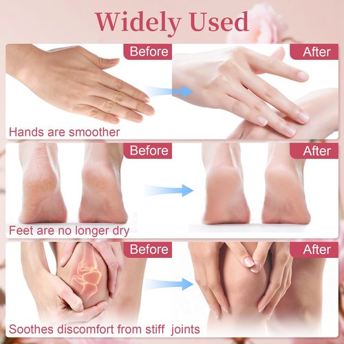 RAQEHO Paraffin Wax for Hand and Feet - 32oz Paraffin Wax Refills 10ml Rose Essential Oil Blocks Hot Wax Hand Foot Care Spa Bath Soak Dry Cracked Peel off Dead Skin Moisturizer Exfoliator Arthritis