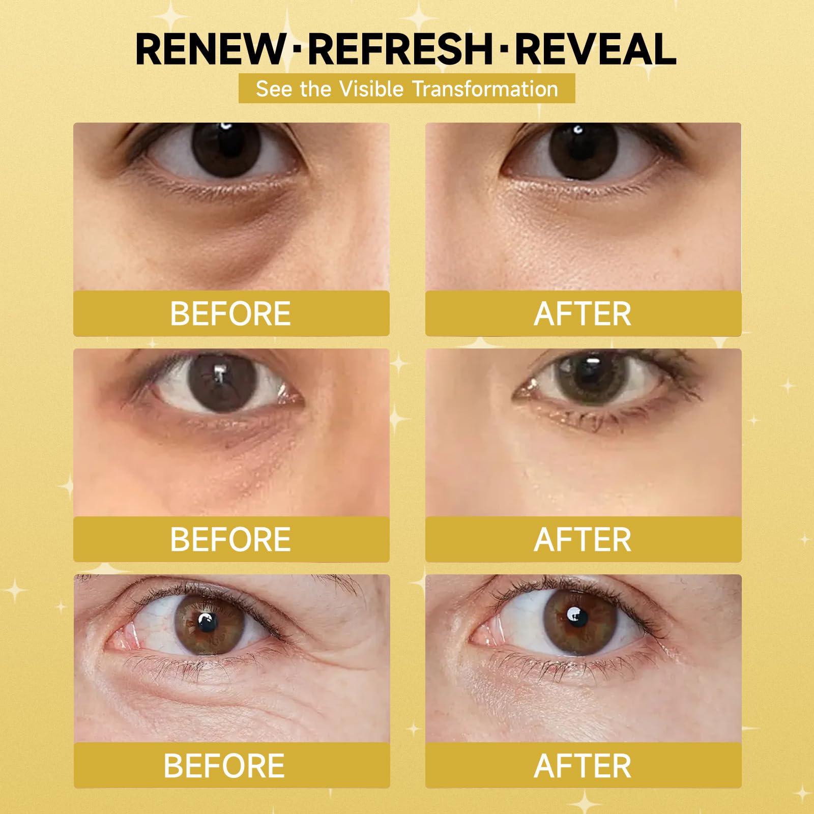 30 pairs 5%PDRN Under Eye Patches, 24K Gold Eye Patches for Puffy Eyes, Dark Circles, Under Eye Bags & Wrinkle | Collagen, Retinol, Hyaluronic, Peptides, Kojic Acid, Caffeine, Korean Skincare Eye care
