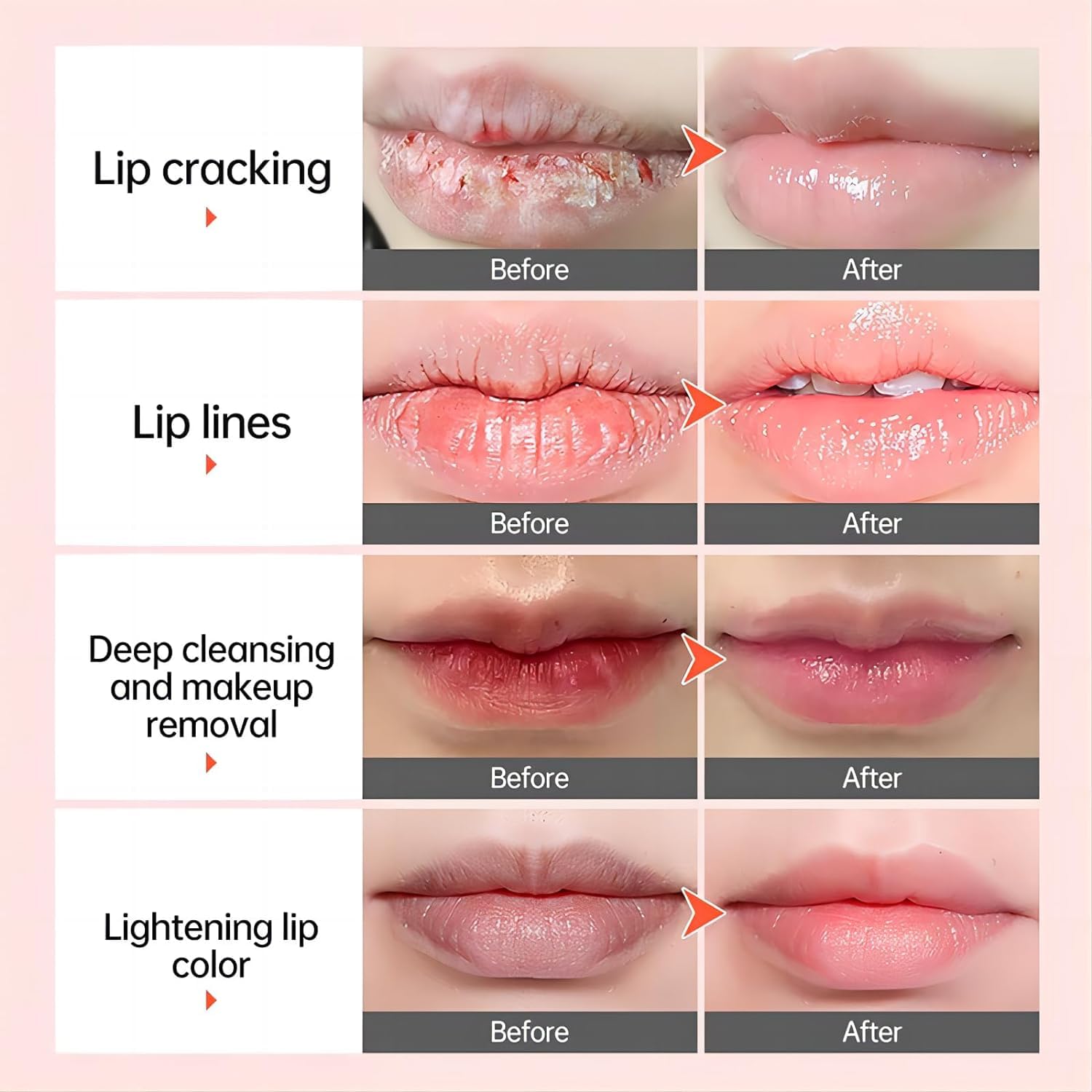 Turmeric Lip Balm for Dark Lips,Lip Lightening For Dark Lips Smoker,Lip Balm for Lip Softening & Hydration, Help Fade Lip Discoloration