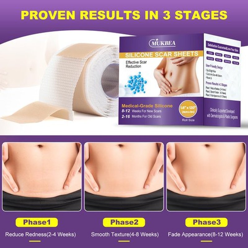 Silicone Scar Sheets, Silicone Scar Tape, Scar Tape for Keloid Bump Removal, Reusable Silicone Scar Strip for C-Section, Keloid, Surgery, Burns, Acne Scar et(1.6”x120”Roll-3M)