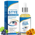 Stye Eye Treatment, Natural Stye Relief Serum for Styes, Chalazions and Blepharitis, Quickly Relieves Eye Irritation and Restores Healthier Skin,30ML