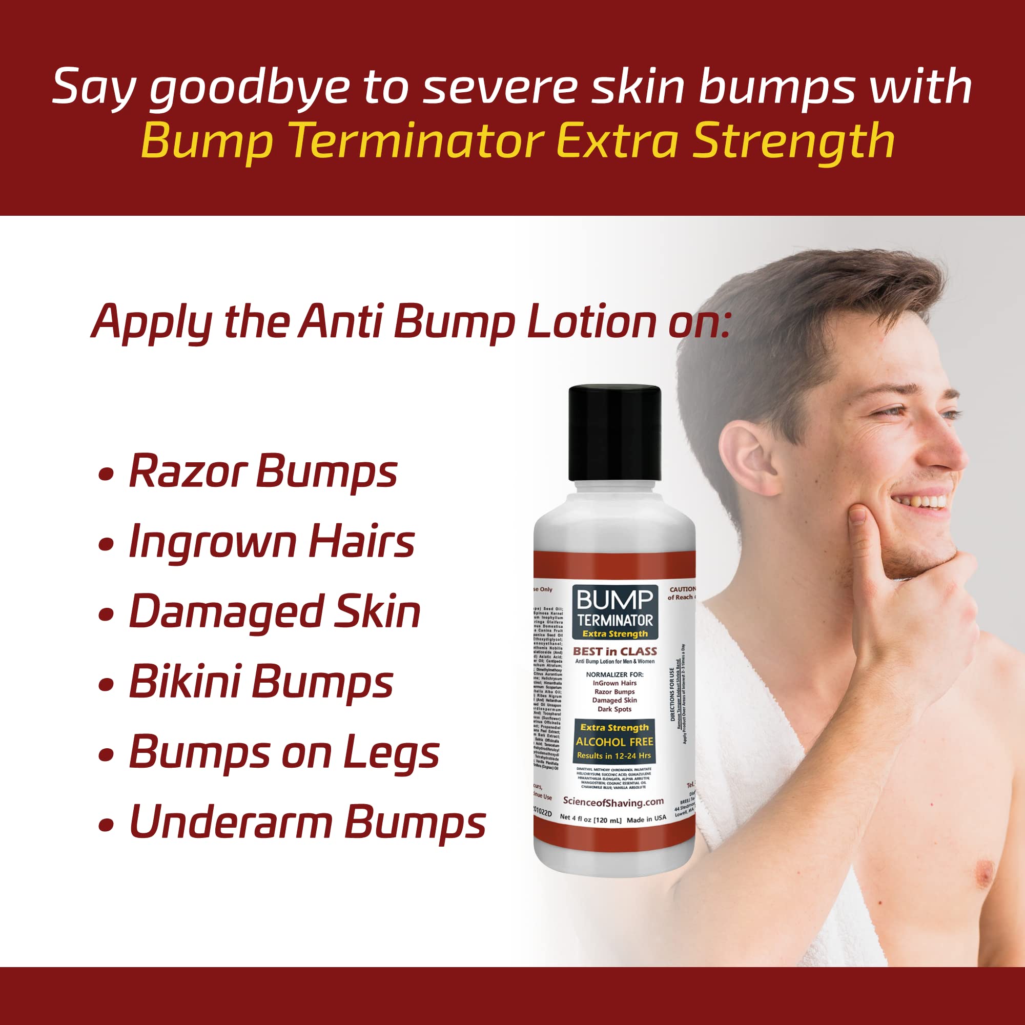 Bump Terminator Extra Strength Alcohol-Free Bumps Lotion, Razor Bump Treatment for Men & Women (4 Fluid Ounces)