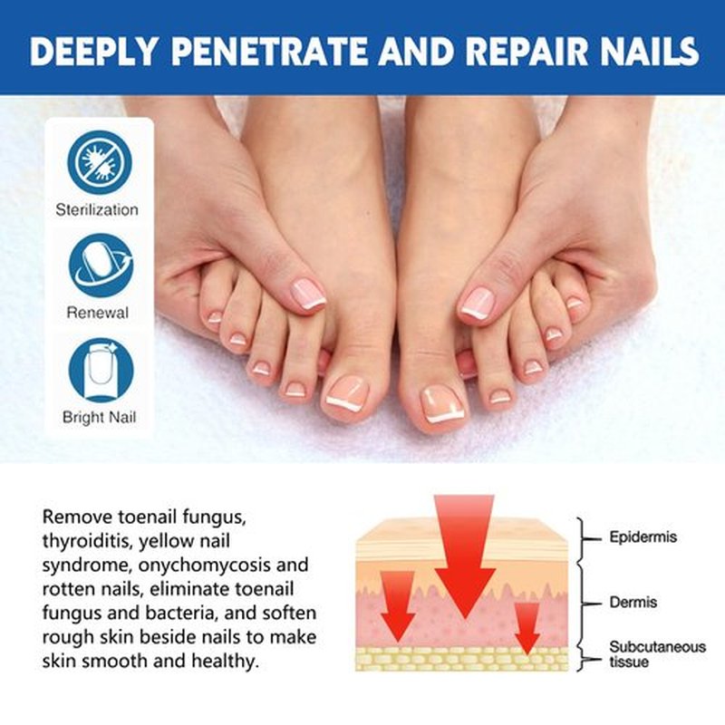 20 Patches Fungal Nail Repair for Toenail Restoration, Treats Thick, Damaged, Discolored or Falling Off Toenails, 8-Hour Intensive Treatment, Includes Nail Care Bandages