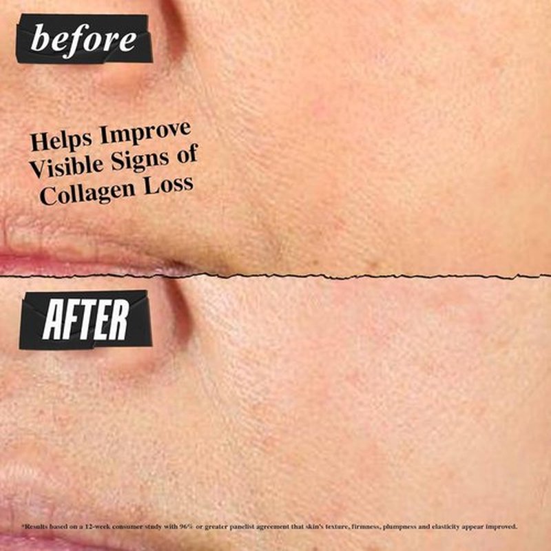 Kiehl's Super Multi-Corrective Cream - Anti-Aging Face & Neck Cream, Evens Skin Tone, Lightweight, Paraben-Free