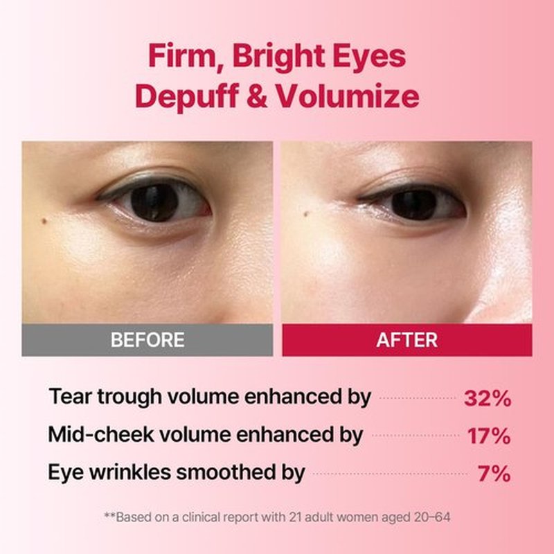 MEDITHERAPY Wrinkle-fit Tangle Eye Patch - Under Eye Patches for Dark Circles and Puffy Eyes - Eye Bags Treatment for Women - Mega Collagen Gel Pads for Puffiness - Firming & Deep Hydrating - 4EA