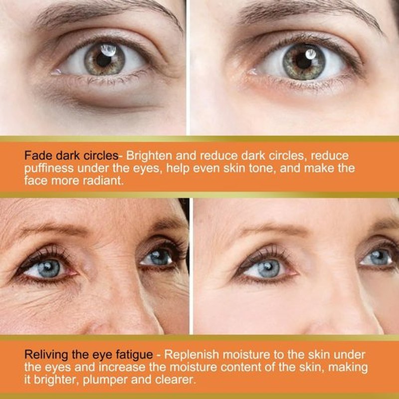 LOYOTICE Vitamin C Eye Balm - Hydrating & Brightening Eye Cream Stick | Reduces Dark Circles & Puffiness