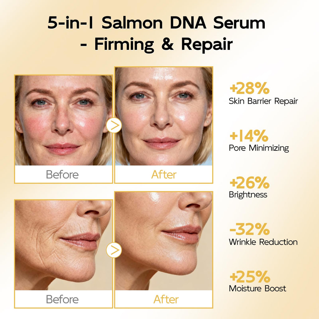 YouthVibe 0.5% PDRN Serum for Face, Anti-Aging Salmon DNA Face Serum with Hyaluronic Acid + Niacinamide + Squalane, Firming & Hydrating, Helps Smooth the Look of Fine Lines & Wrinkles, 30mL