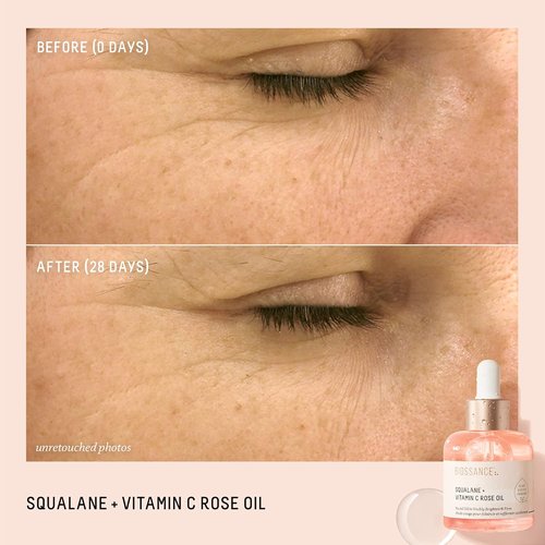 BIOSSANCE Squalane + Vitamin C Rose Facial Oil - Brightening & Hydrating Serum for All Skin Types | Chios Crystal Oil & Damascus Rose Extract