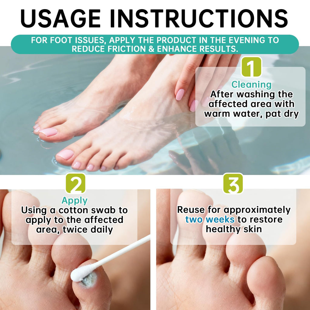 SERYNTH Salicylic Acid Wart Remover Liquid Freeze Off, Quickly Removes Plantar Warts, Corn Warts, and Finger Warts. Maximum Strength Formula - 17%, Painless & Safe, Effective, Scar-Free Solution.