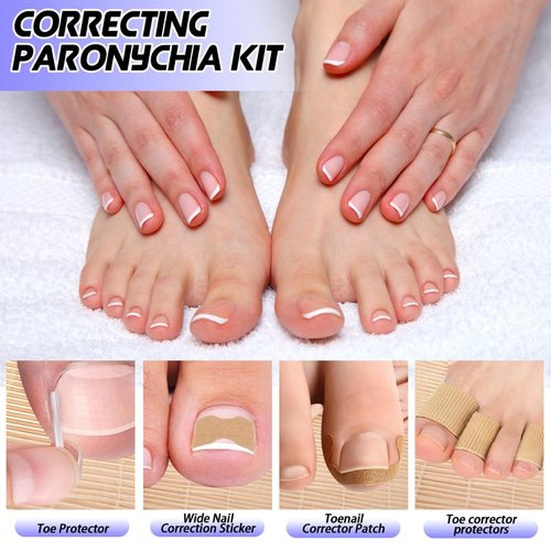 Ingrown Toenail Removal Kit, Ingrown Toenail Tool with Ingrown Toenail Strips, Curved Toenails Corrector Patch, Painless File and Lifter, Ingrown Nail Correction Home Care for Men and Women.