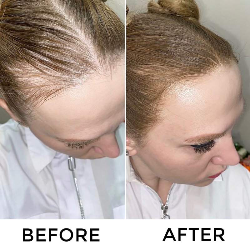 VOLLUCK Root Touch Up Hair Color Spray - Ammonia-Free Grey Coverage for Men & Women | Quick Drying Black
