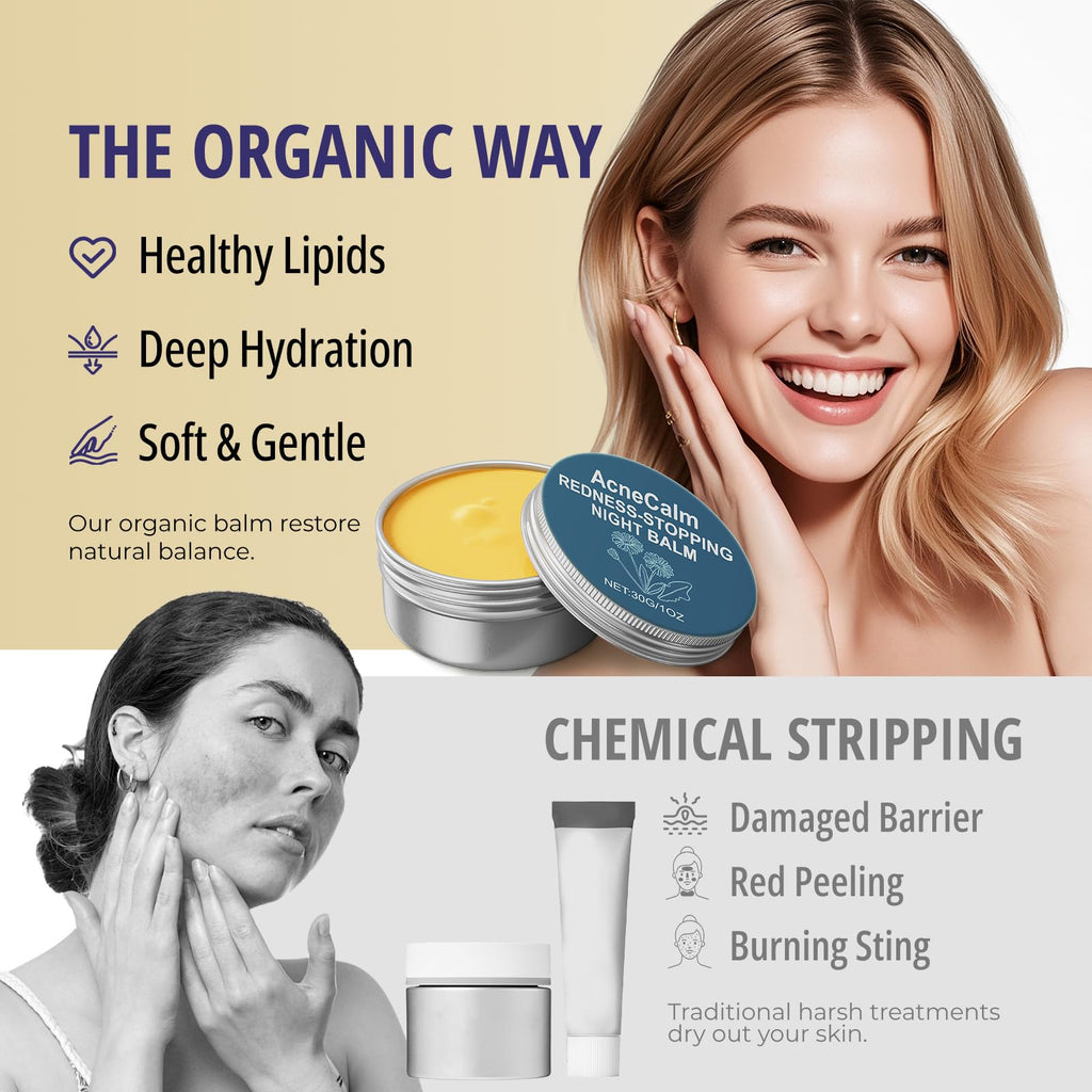 Bealions Organics Acne Killer Night Balm, 30g