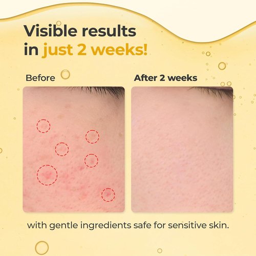 Glutathione Brightening Serum - All-In-One Formula with Niacinamide, Kojic Acid & Turmeric for Radiant Skin