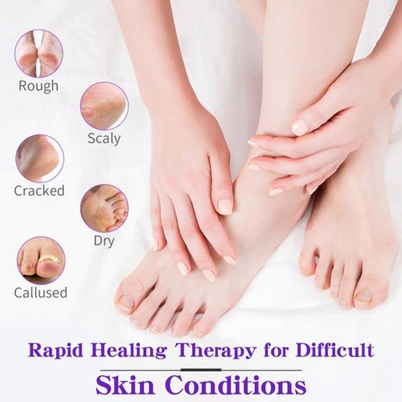 nbc BeautiLab Foot Callus Remover, Hand & Foot Cream, Lotion for Extremely Dry Skin, Athletes Foot Treatment, Pedicure Foot Spa Products for Dry Hands, Cracked Feet, Rough and Dry Skin, 80ml Lavender