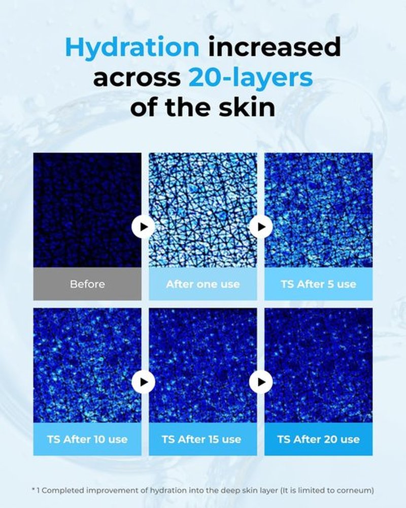 BOM Hyaluronic Acid Moisturizing Serum 1.69 fl oz, Lightweight Vegan Facial Serum with Moisture Capsules and Vitamins, Deep 20 Layer Hydration, Face Plumping, Hypoallergenic, Dry Skin Korean Skincare