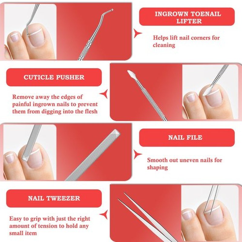 Ingrown Toenail Removal Kit, Professional Ingrown Toenail Treatment, Ingrown Toenail Tools Kit with Ingrown Toenail Corrector Drops, Toenail Clipper, Corrector Patch, Stainless Steel Pedicure Tool Set
