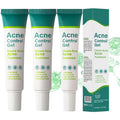 Azelaic Acid Serum by Regine Switzerland - Acne Treatment & Pore Refining Cream | 30ml for Sensitive Skin