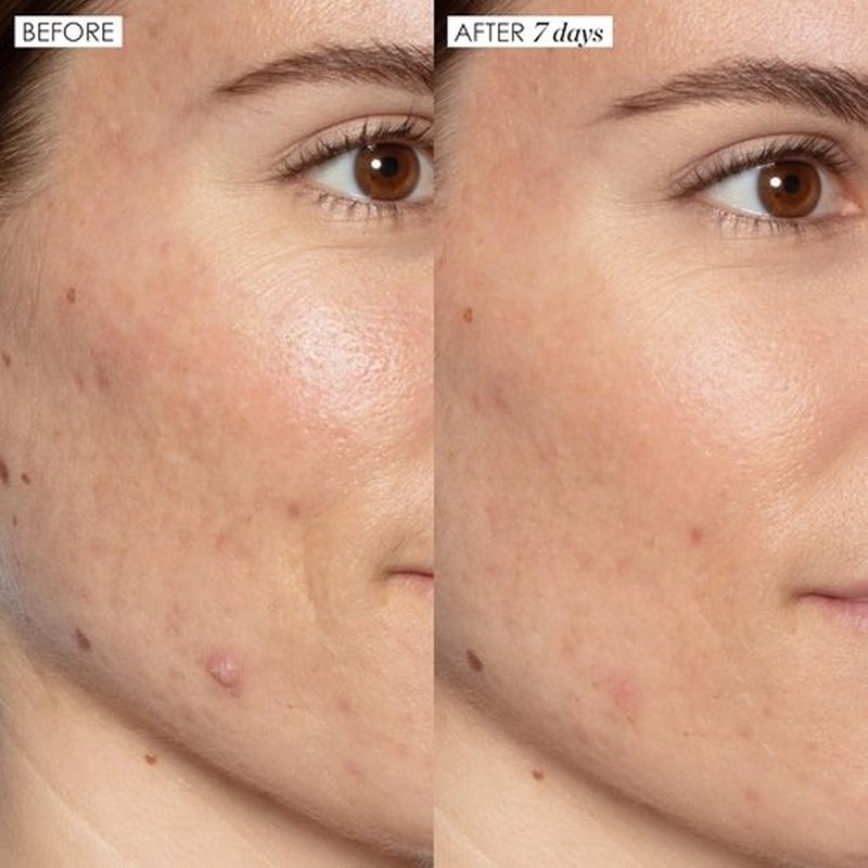 Sunday Riley Good Genes Lactic Acid Treatment Serum - Brightening & Exfoliating Face Care