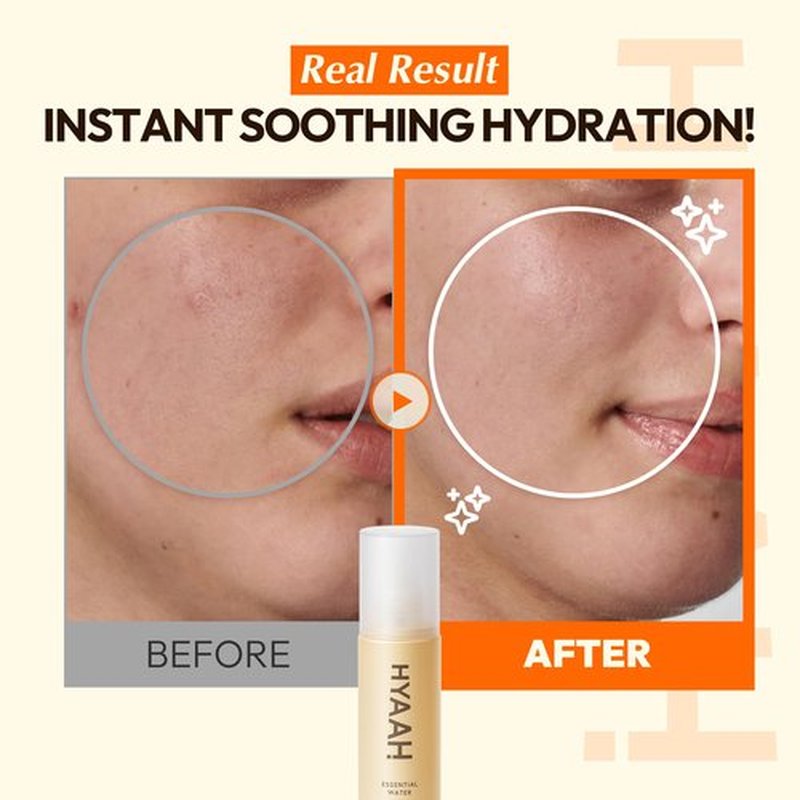 HYAAH All-Day Essential Water - Korean Face Mist Spray - Hydrating Soothing with Chamomile Extract and Houttuynia Cordata - Moisturizing, Calming, Pore Care Daily Skincare, 3.38oz