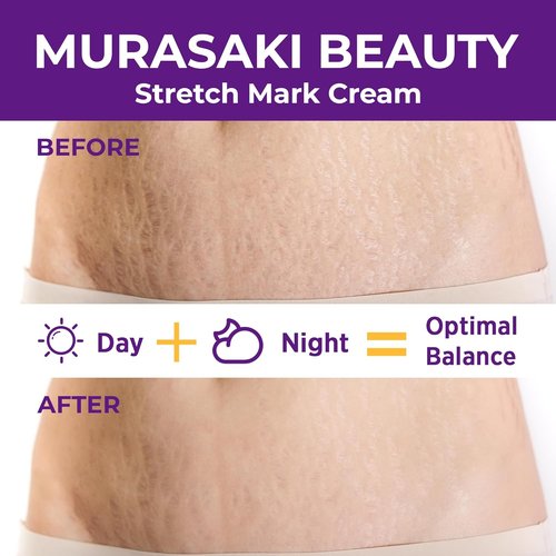 Skiennix Stretch Mark Cream - Nourishing Maternity Formula for Prevention & Elasticity | 4 oz (120g)