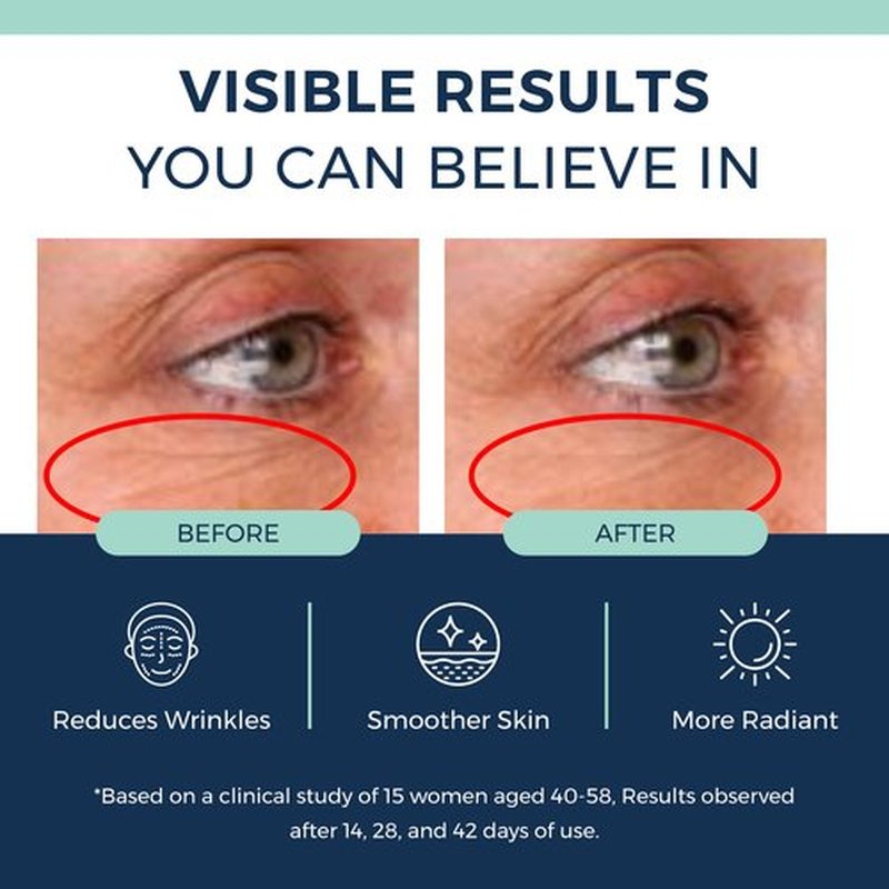 Clinexil Anti-Aging Retinol Collagen Serum for Face- 1% Encapsulated Retinol, Niacinamide & Hyaluronic Acid Improves Wrinkles, Hydration, Skin Texture. Gentle for Sensitive Skin-Fragrance Free-1 FL OZ