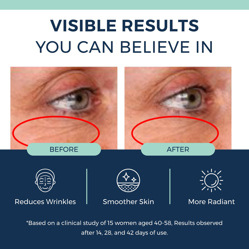 Clinexil Anti-Aging Retinol Collagen Serum for Face- 1% Encapsulated Retinol, Niacinamide & Hyaluronic Acid Improves Wrinkles, Hydration, Skin Texture. Gentle for Sensitive Skin-Fragrance Free-1 FL OZ
