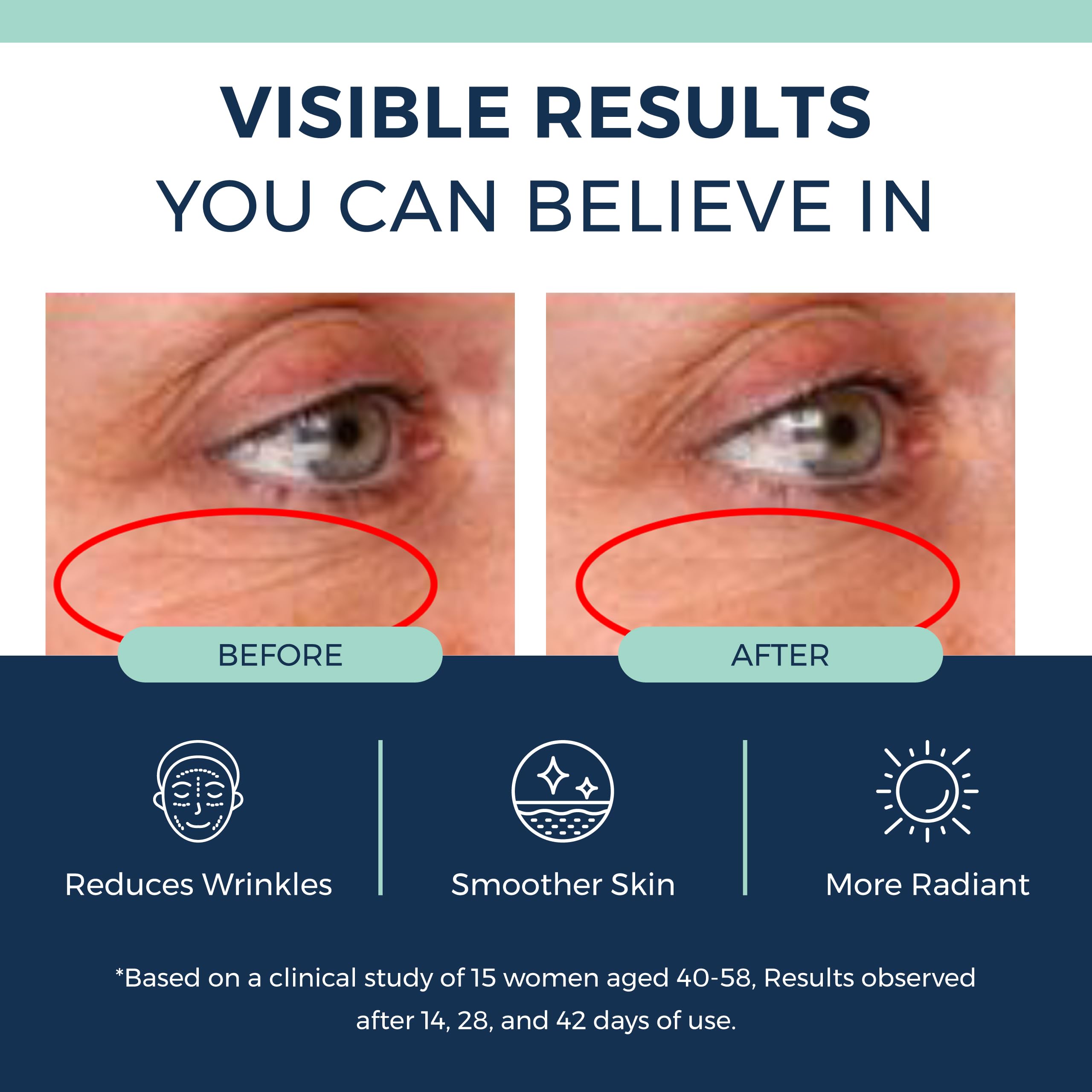 Clinexil Anti-Aging Retinol Collagen Serum for Face- 1% Encapsulated Retinol, Niacinamide & Hyaluronic Acid Improves Wrinkles, Hydration, Skin Texture. Gentle for Sensitive Skin-Fragrance Free-1 FL OZ