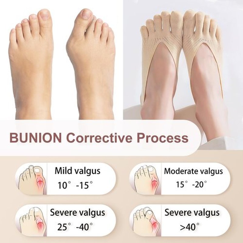 MoHern 6 Pairs Toe Socks for Bunions, Low Cut Sockalign USA Toe Socks for Women, Five Finger Bunion Socks for Women