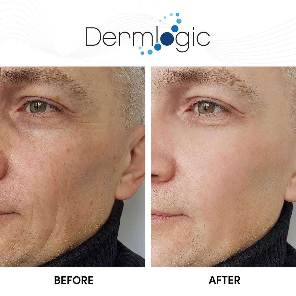 Glycolic Cream 15% - Natural Anti Aging Exfoliator to Smooth Away Fine Lines & Wrinkles & Improve a Dull Looking Complexion. Includes A.H.A & Green Tea Moisturizer for Face & Body.