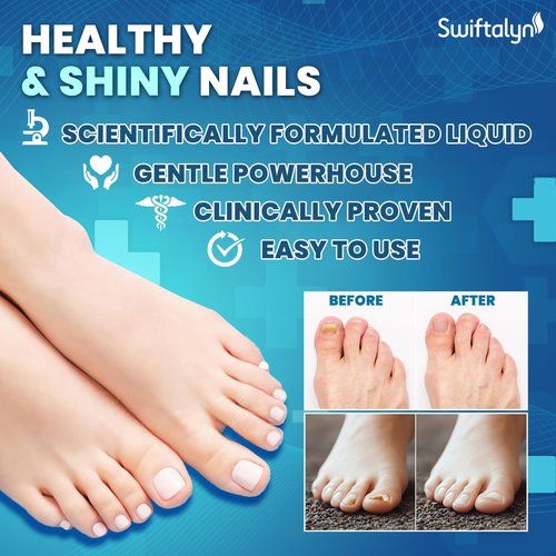 Nail Treatment For Toenails: Extra Strength Nail Solution with Brush for Toenails, Fingernails, Cuticles, Ingrown Nail Treatment - Fast Repair & Growth Formula 20ml