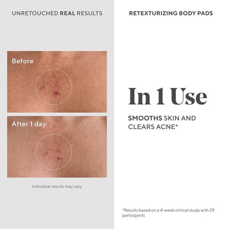 Murad Retexturizing Body Pads - Acne-Fighting Exfoliating Pads with Azelaic, Salicylic & Glycolic Acid | 45 Pads
